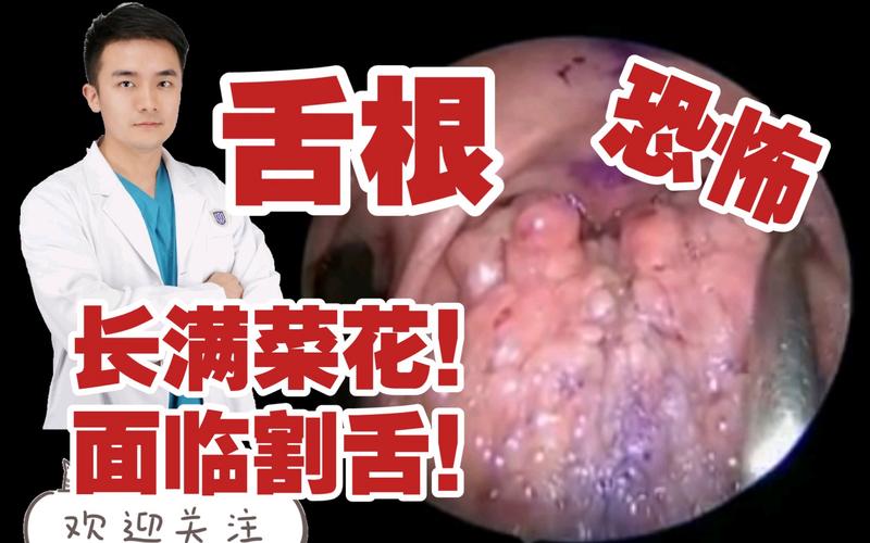 2025新澳门天天开奖记录下载和舌根和牙龈被缝一起与舌根和牙龈被缝一起怎么办